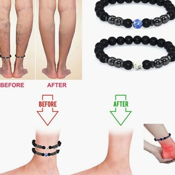 Anti swelling black obsidian stretch stone bracelet. - Picture 6 of 8